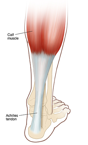 Back view of foot and calf showing bones and Achilles tendon.